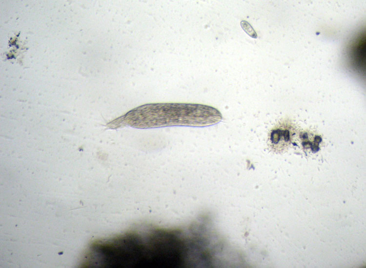 Microscopia delle spiagge adriatiche